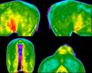 Hindquarter/Spine Scan