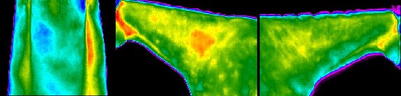 Neck Scan